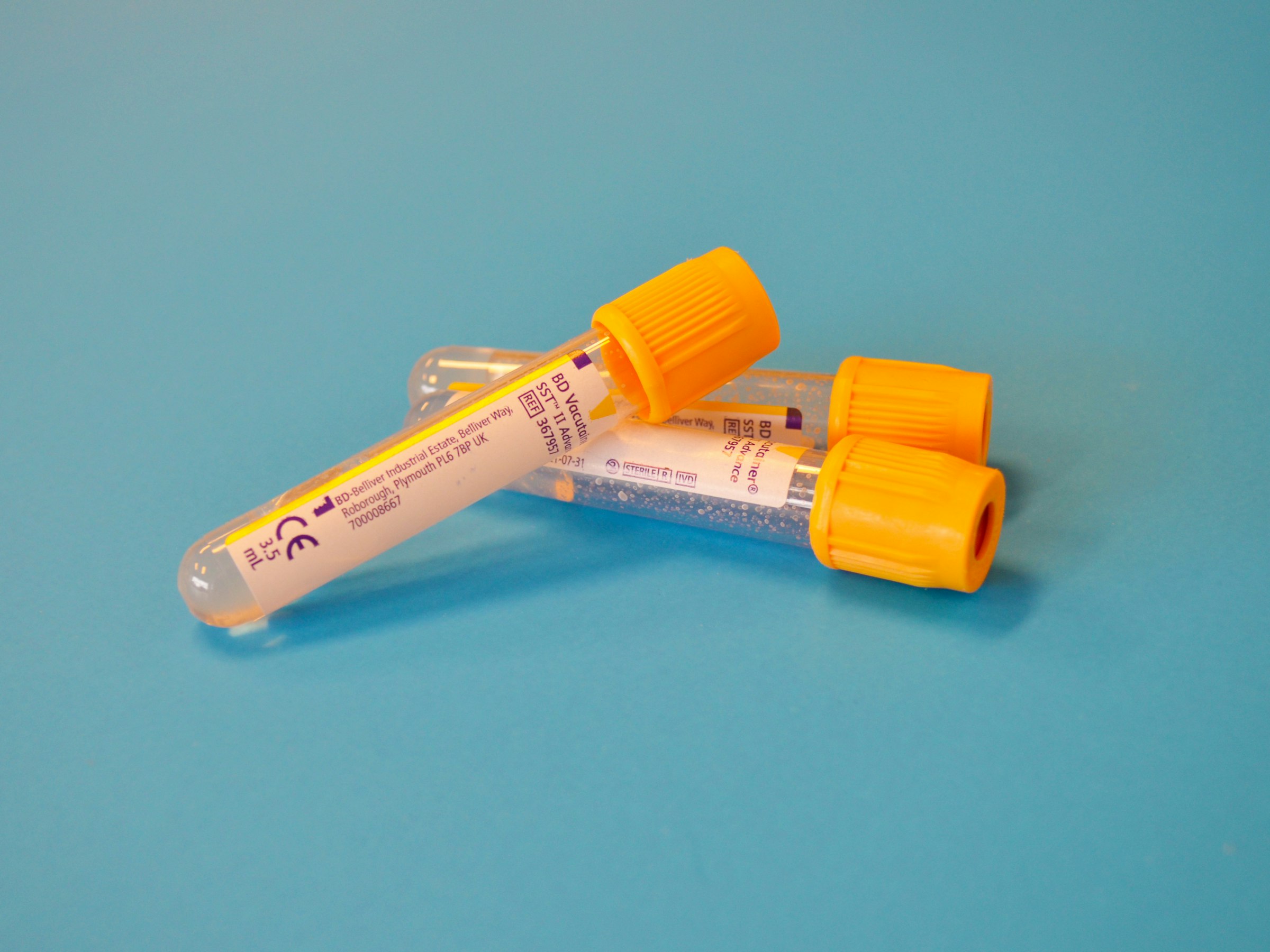 Blood collection tubes used for lab testing at Whitfield Family Practice in Decatur, AL