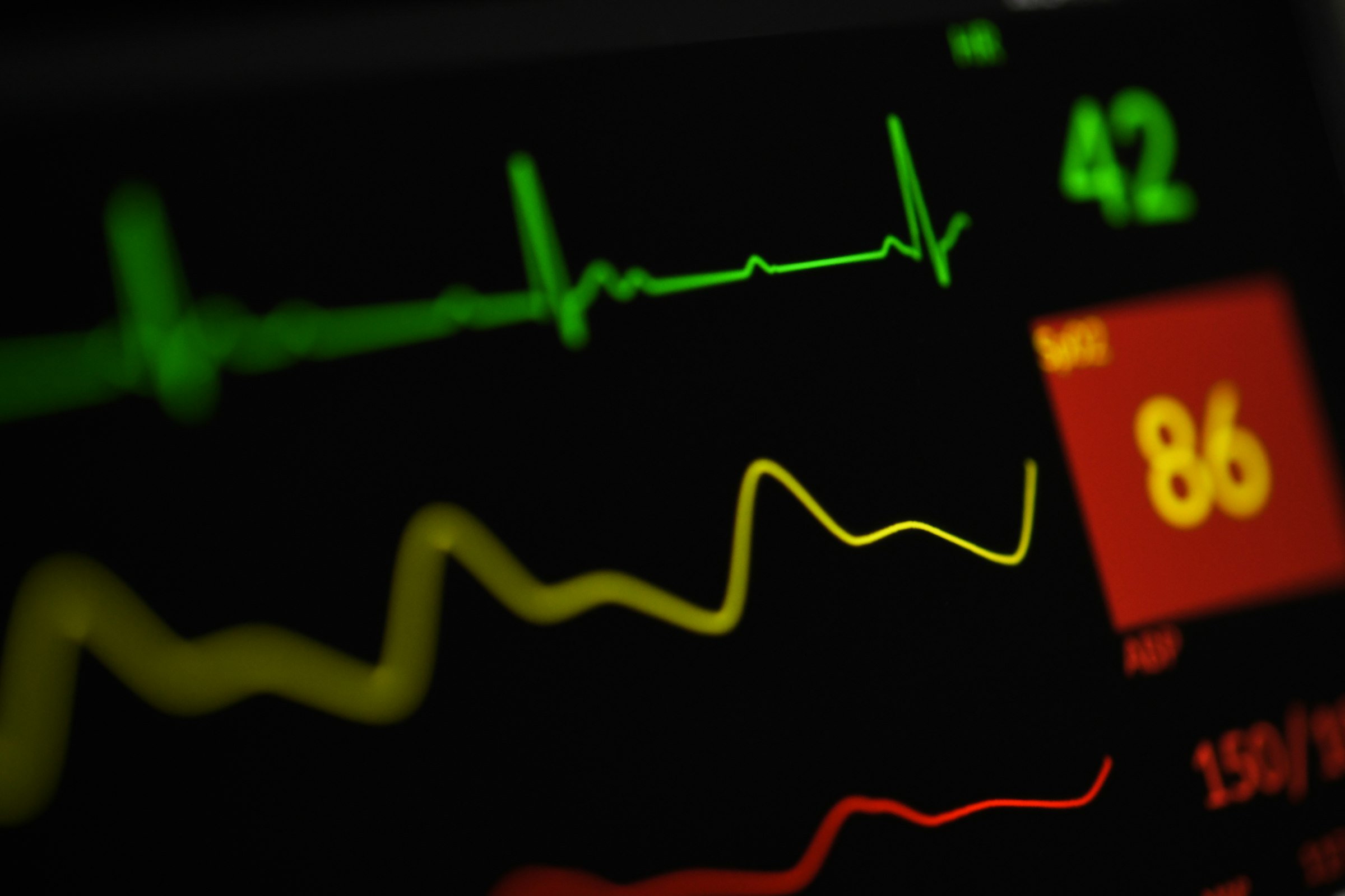 Heart rate monitor representing medical testing at Whitfield Family Practice in Decatur, AL